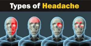 Migraine Headache Effects: Symptoms and Variability